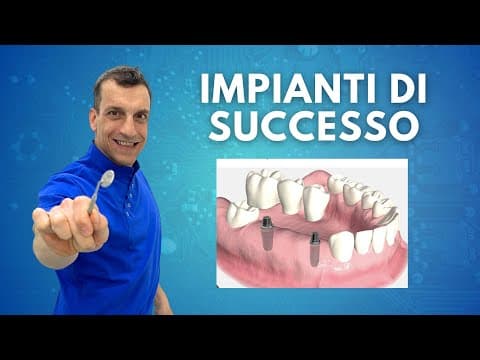 Implantologia Dentale: Configurazioni Protesiche e Cantilever
